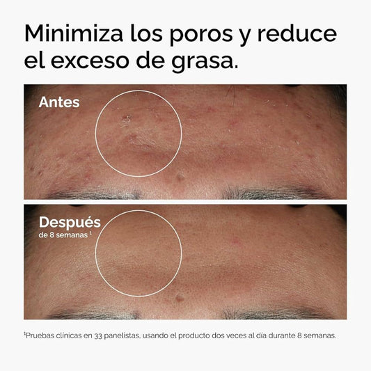 Niacinamide ,10% + Zinc 1%, Suero para Imperfecciones suaviza e ilumina.