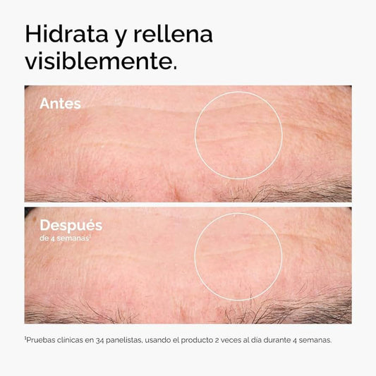 Suero con Ácido Hialurónico y Ceramidas —hidratación multiprofunda para piel más suave