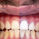 PURPLE V34 - Pasta Blanqueadora Dental