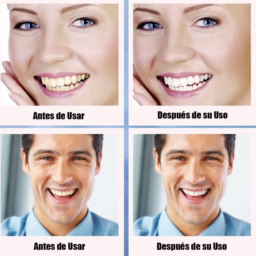 Tiras Blanqueadoras Dientes, Eficaces Para Limpiar Los Dientes
